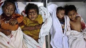 در جنگ يمن 5000 کودک کشته يا زخمي شده‌اند
