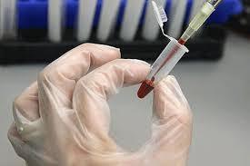افزایش 66درصدی ذخیره‌سازی خون بند ناف در چهارمحال و بختیاری