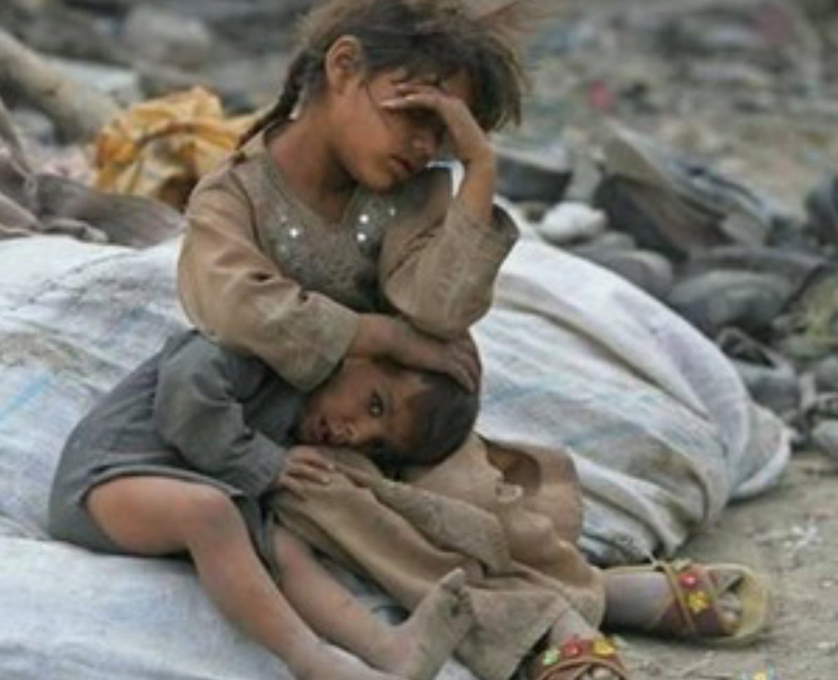 زمان برای جلوگیری از قحطی در یمن در حال تمام شدن است