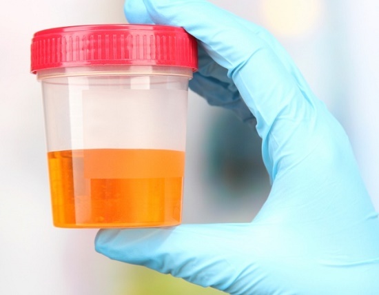 عجیب‌ترین و متفاوت‌ترین اشکال پول در سراسر دنیا