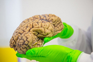 مسابقه ایده پردازی کاربرد‌های تصویربرداری تشدید مغناطیسی کارکردی مغز برگزار می‌شود