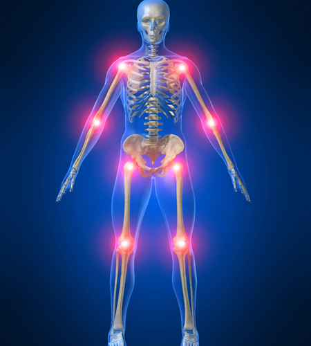 چگونه درد مفاصل را کاهش دهیم؟