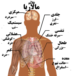 گزارش مکتوب؛ ایران الگوی موفق در کنترل بیماری مالاریا در جهان