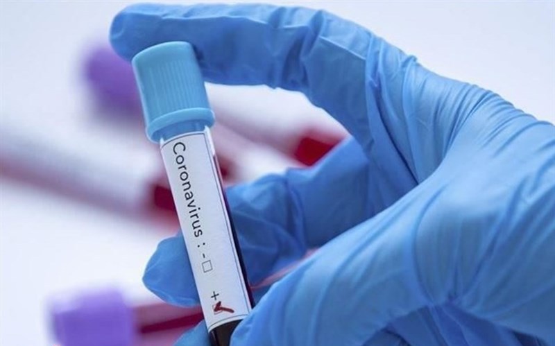 شناسایی 7 نفر دیگر بیمار مبتلا به ویروس کرونا شناسایی 7 نفر دیگر بیمار مبتلا به ویروس کرونا