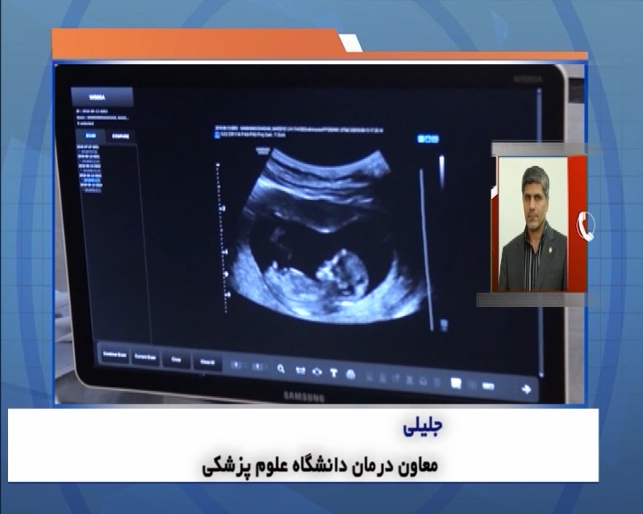 کمبود رادیولوژی بانوان در قطب گردشگری سلامت غرب کشور