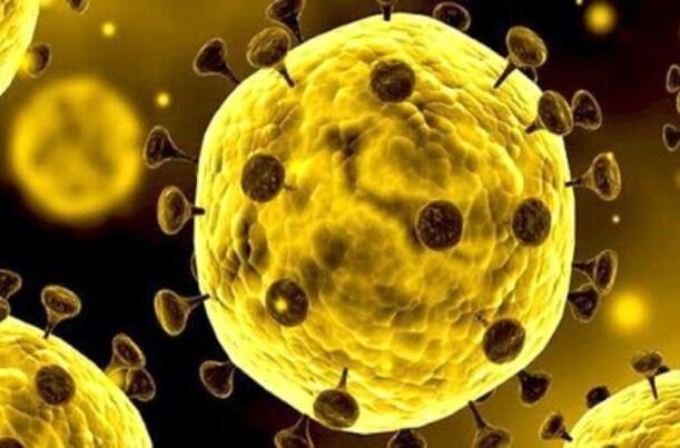 رنگ کرونایی بردسکن زرد شد