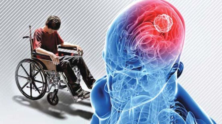 اسیدچرب به مقابله با بیماری ام اس کمک می کند
