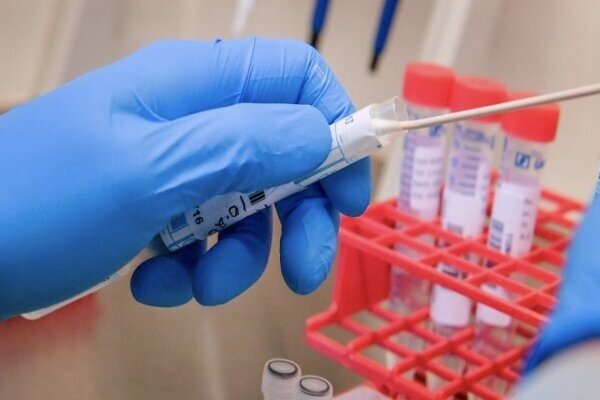 نرخ تست PCR در بخش خصوصی ۳۱۰هزار تومان