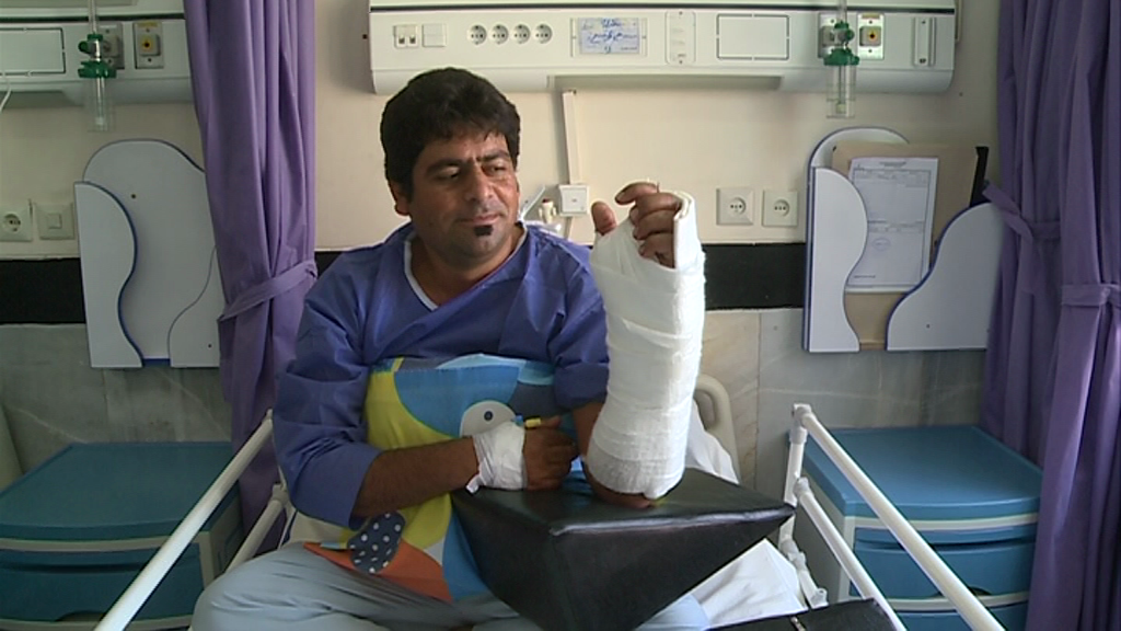 عمل موفقیت آمیز پیوند دست 2 بیمار در کرمان