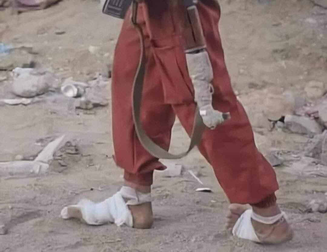 بازتاب تصویر یک مجاهد یمنی بازتاب تصویر یک مجاهد یمنی