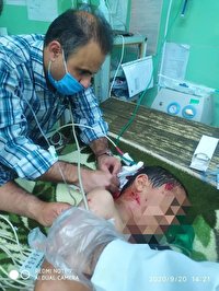 جراحت شدید کودک 8 ساله سردشتی به دلیل  حمله سگ های ولگرد جراحت شدید کودک 8 ساله سردشتی به دلیل  حمله سگ های ولگرد