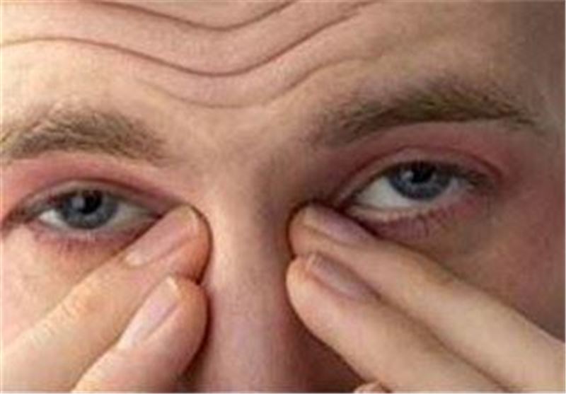 احساس سوزش در بینی نشانه چیست؟ آیا به کرونا ربطی دارد؟ احساس سوزش در بینی نشانه چیست؟ آیا به کرونا ربطی دارد؟