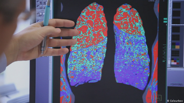 چرا کرونا برای افراد دارای سابقه بیماری خطرناک&zwnj;تر است؟