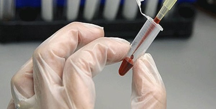 دریافت وام برای ذخیره سازی خون بند ناف دریافت وام برای ذخیره سازی خون بند ناف