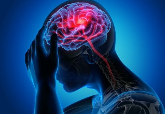 شایع ‌ترین عارضه های عصبی کرونا