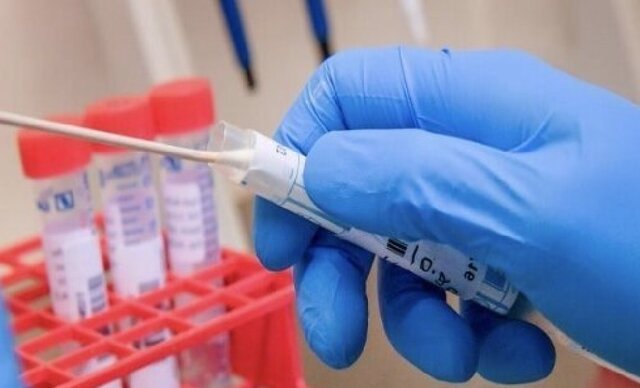 انجام ۸۴۲ تست کرونا در فرودگاههای شیراز و لار انجام ۸۴۲ تست کرونا در فرودگاههای شیراز و لار