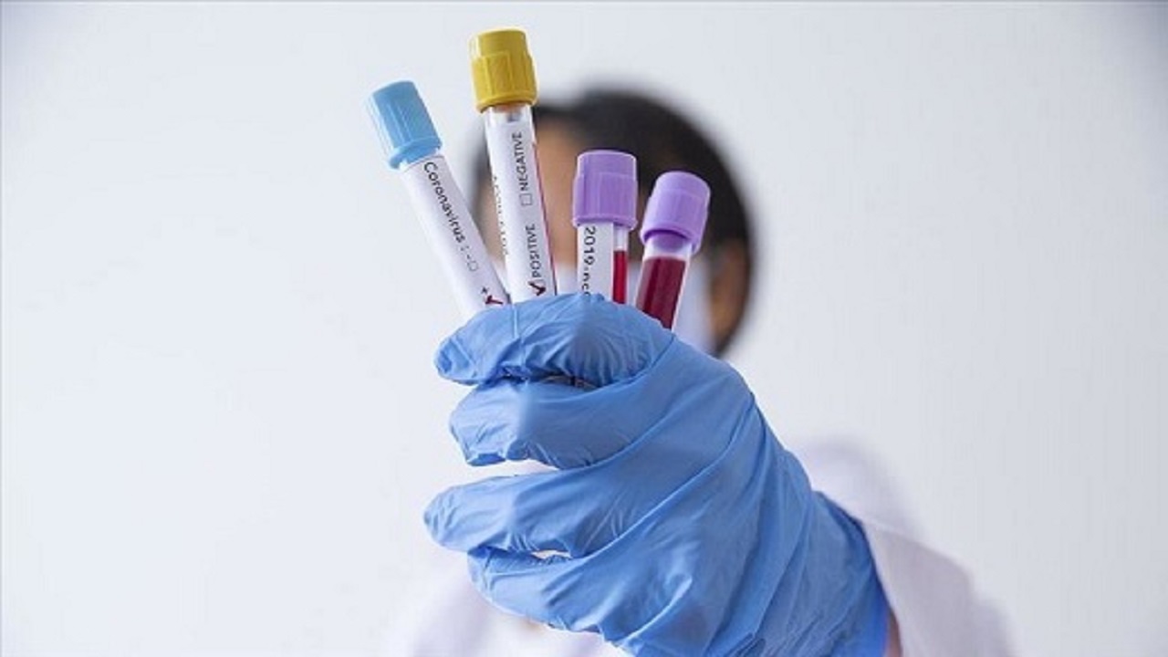 تنور کرونا در هندیجان داغ‌تر از همیشه