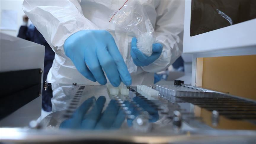 توزیع بیش از یک میلیون و ۵۰۰ هزار کیت تشخیص سریع آنتی ژن کرونا