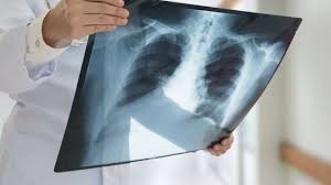 کاهش ۴۸ درصدی بیماران بستری کرونا در خوزستان کاهش ۴۸ درصدی بیماران بستری کرونا در خوزستان