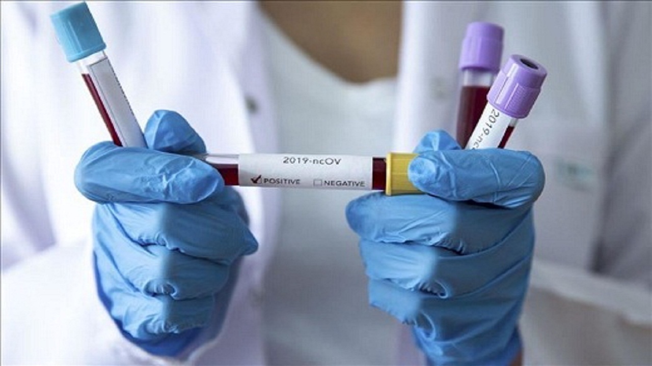 هندیجان لبه تیغِ کرونا هندیجان لبه تیغِ کرونا