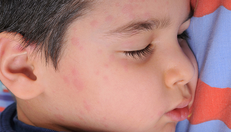 تب کودک نگران&zwnj;کننده است؟