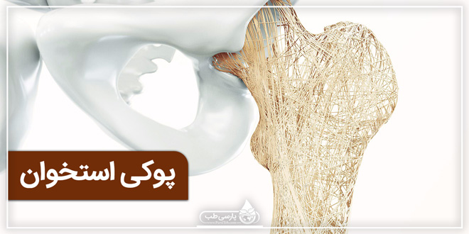 ۲۸ مهر روز جهانی مبارزه با پوکی استخوان ۲۸ مهر روز جهانی مبارزه با پوکی استخوان