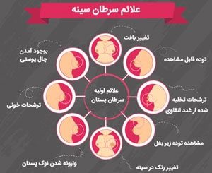 سرطانی شایع در بین زنان