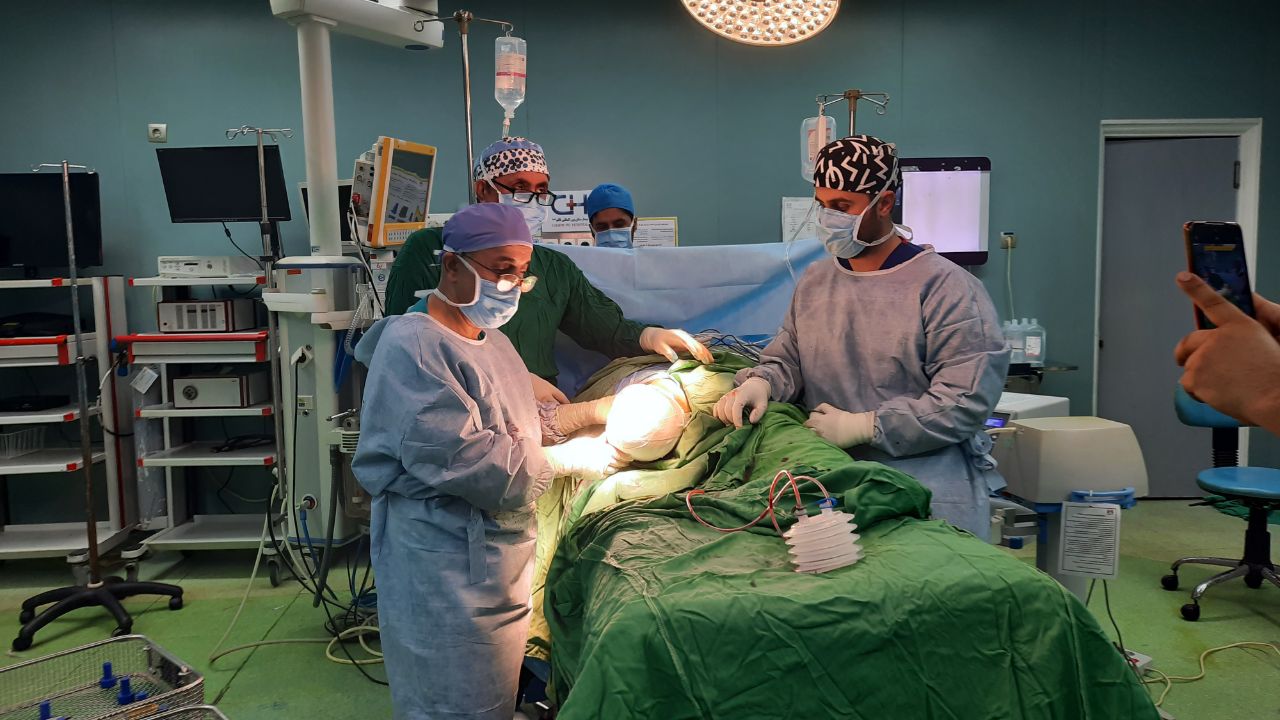 انجام عمل کاشت پای مصنوعی در رشت