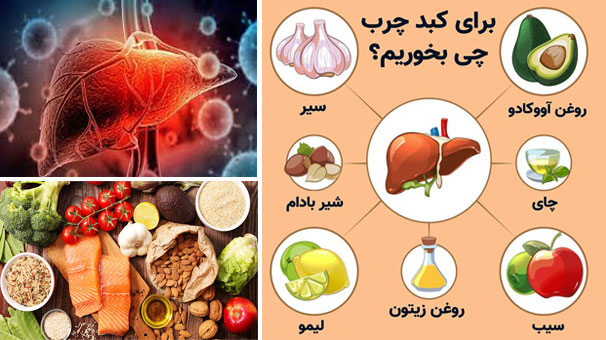 مقابله با کبد چرب با تغییر سبک زندگی