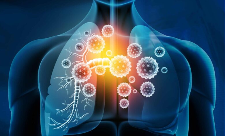 کشف گروهی از سلول‌های T، که التهاب در ریه‌ها را کنترل می‌کند