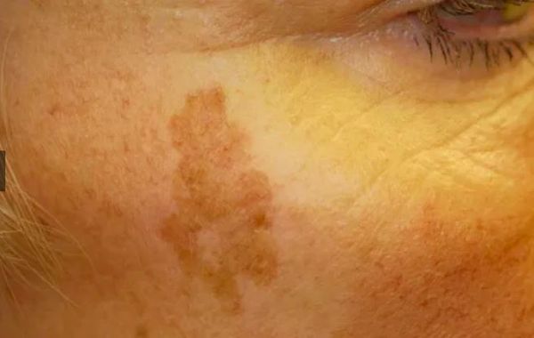 مشکلات پوستی، زنگ خطر اختلالات ارگانهای درونی مشکلات پوستی، زنگ خطر اختلالات ارگانهای درونی