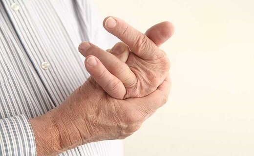 آنچه بیماران مبتلا به روماتیسم مفصلی باید بدانند آنچه بیماران مبتلا به روماتیسم مفصلی باید بدانند