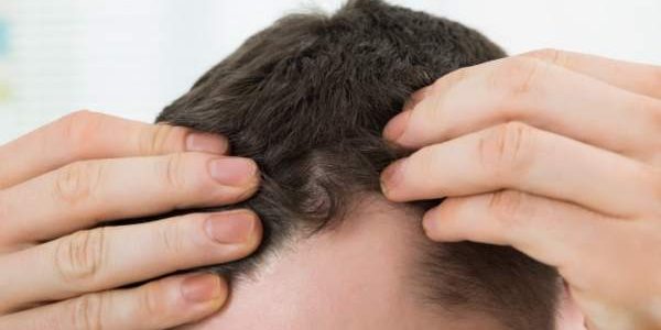 ارائه راهکاری جهت کنترل «وسواس موکنی»