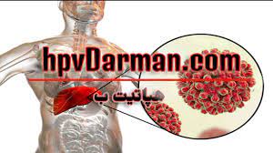 کاهش چشمگیر موارد بیماری هپاتیت B در گروه سنی زیر ۳۰ سال
