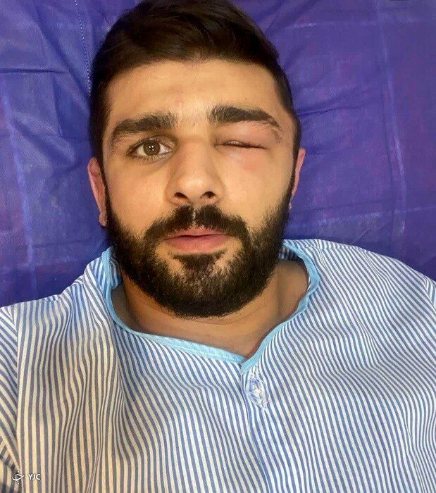 جراحی کشتی گیر ملی پوش مازندرانی