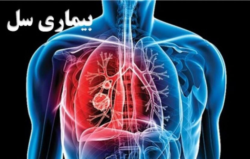 به ازای حدود هر صد هزار نفر، ۱۱/۳ نفر مبتلا به سل هستند