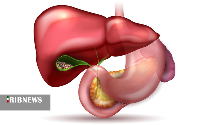 نشانههای بروز مشکل کیسه صفرا درد صفرا