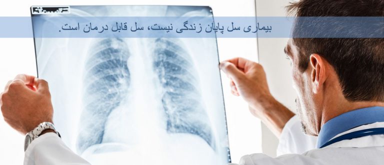 روز جهانی بیماری سل، راههای تشخیص بیماری سل و نشانههای آن روز جهانی بیماری سل، راههای تشخیص بیماری سل و نشانههای آن