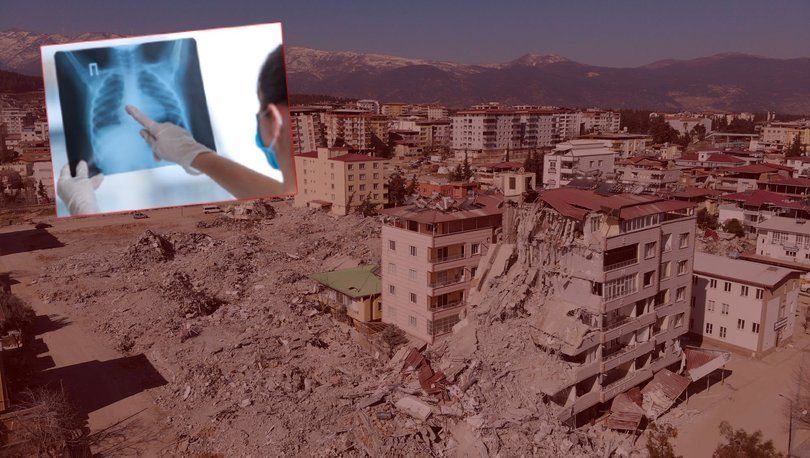 هشدار در مورد شیوع بیماری سل در مناطق زلزله زدۀ ترکیه