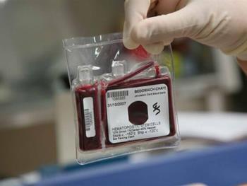 یافته های اخیر محققان درخصوص عمر مفید سلولهای بنیادی خون بندناف (ویترین / منبع : پایگاه اطلاع رسانی سلول های بنیادی ایران ) یافته های اخیر محققان درخصوص عمر مفید سلولهای بنیادی خون بندناف (ویترین / منبع : پایگاه اطلاع رسانی سلول های بنیادی ایران )