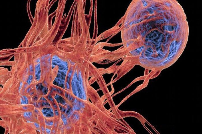 سرطان معده، سینه و پروستات سه سرطان شایع در اردبیل سرطان معده، سینه و پروستات سه سرطان شایع در اردبیل