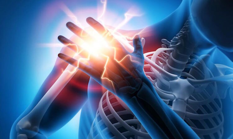 درد شانه دردی که شما را بی حرکت می‌کند