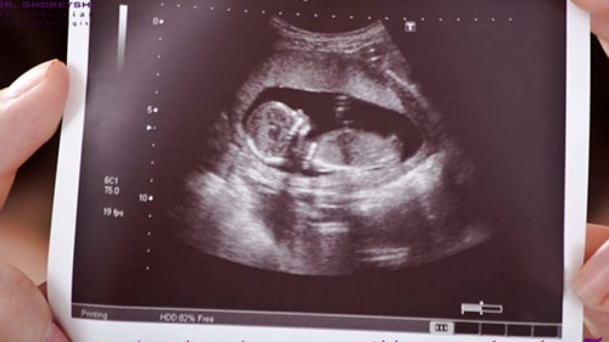 بزرگترین طرح درمانی استان ، معطل برای یک تصمیم