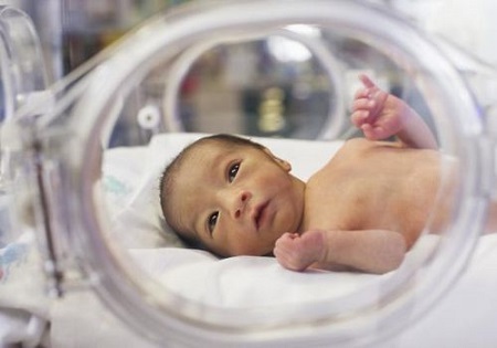 مراقبت کانگرویی راهی برای کمک به نوزادان نارس مراقبت کانگرویی راهی برای کمک به نوزادان نارس