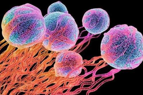 سلول درمانی بیماران مبتلا به تومورهای مغزی تهاجمی سلول درمانی بیماران مبتلا به تومورهای مغزی تهاجمی