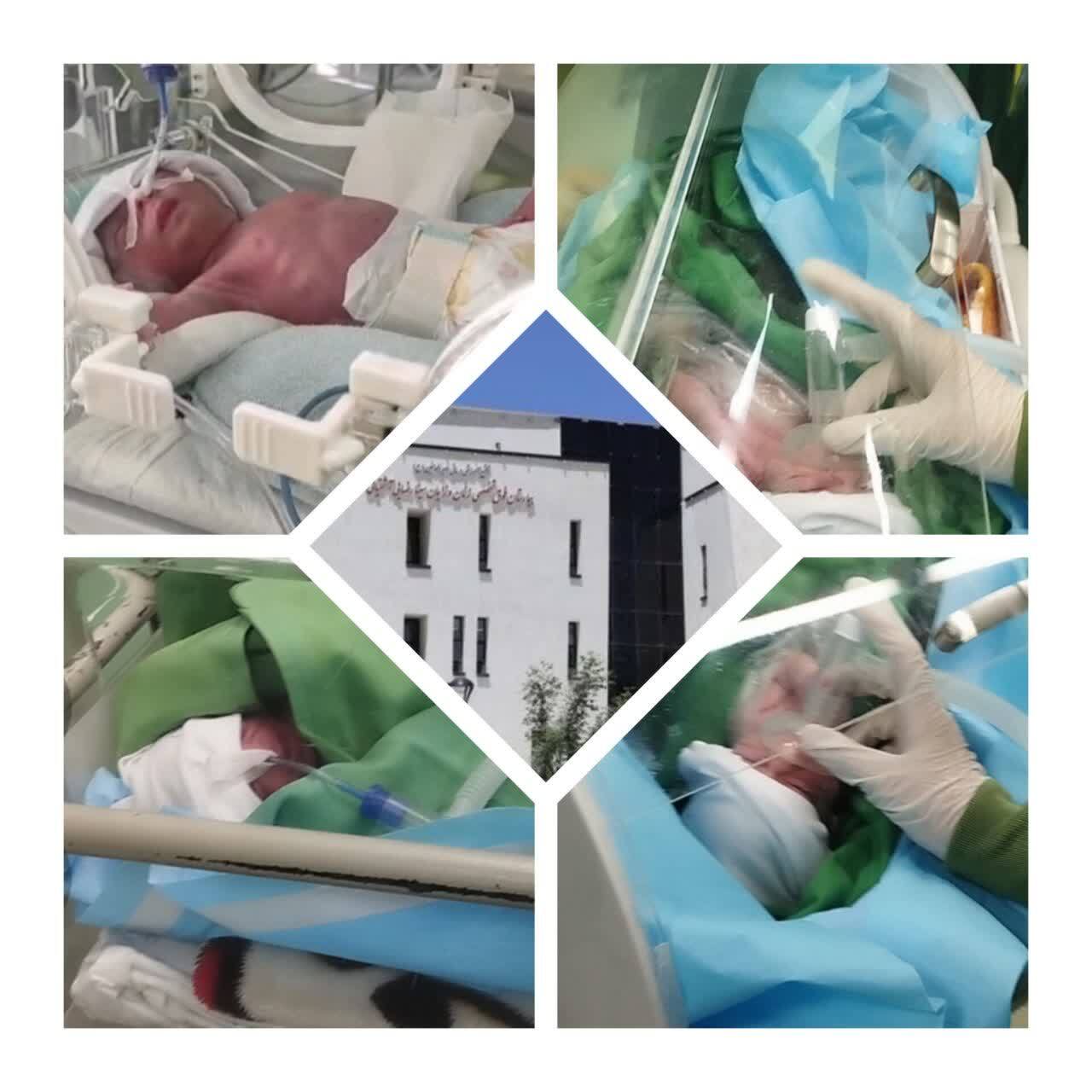 تولد چهارقلوها در بیمارستان زنان و زایمان سینا رضایی آشتیانی تولد چهارقلوها در بیمارستان زنان و زایمان سینا رضایی آشتیانی