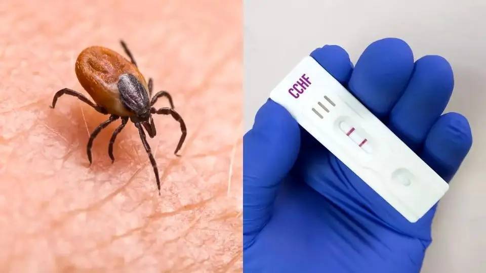 شناسایی یک مورد ابتلا به بیماری تب کریمه کنگو در خوشاب شناسایی یک مورد ابتلا به بیماری تب کریمه کنگو در خوشاب