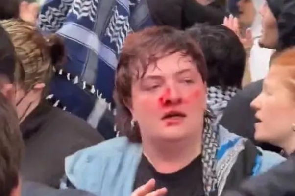 تظاهرات علیه اظهارات نژاد پرستانه صدراعظم آلمان