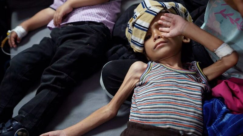 یونیسف: هزاران کودک در نوار غزه از سوء تغذیه شدید رنج میبرند یونیسف: هزاران کودک در نوار غزه از سوء تغذیه شدید رنج میبرند