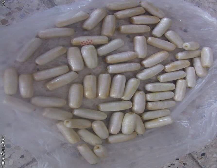 جاساز ۱۰۰ بسته تریاک در معده  یک مسافر در قائن